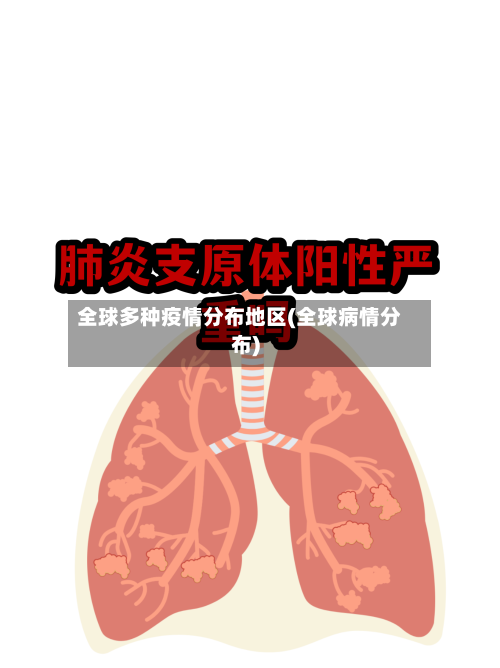 全球多种疫情分布地区(全球病情分布)-第1张图片