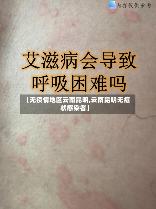 【无疫情地区云南昆明,云南昆明无症状感染者】-第1张图片