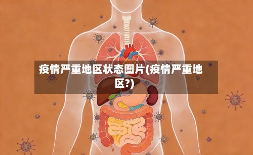 疫情严重地区状态图片(疫情严重地区?)-第2张图片