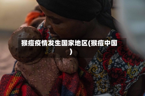 猴痘疫情发生国家地区(猴痘中国)-第3张图片