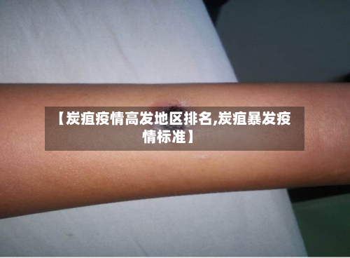 【炭疽疫情高发地区排名,炭疽暴发疫情标准】-第2张图片