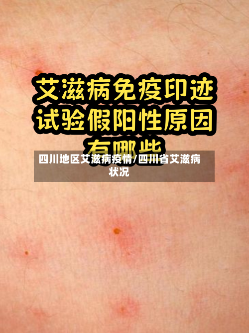 四川地区艾滋病疫情/四川省艾滋病状况-第3张图片